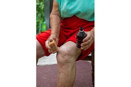 Grandmother treats her knees with, a Health & Medical Photo by yanadjana
