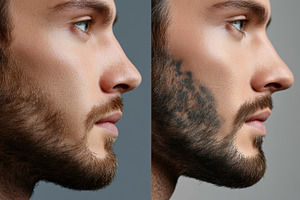 Transformation of a man's facial, a Photo by Pavel_design