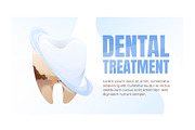 Dental Care Posters Set, a Marketing Template by EeKayStore (Thumbnail 2 of 7)
