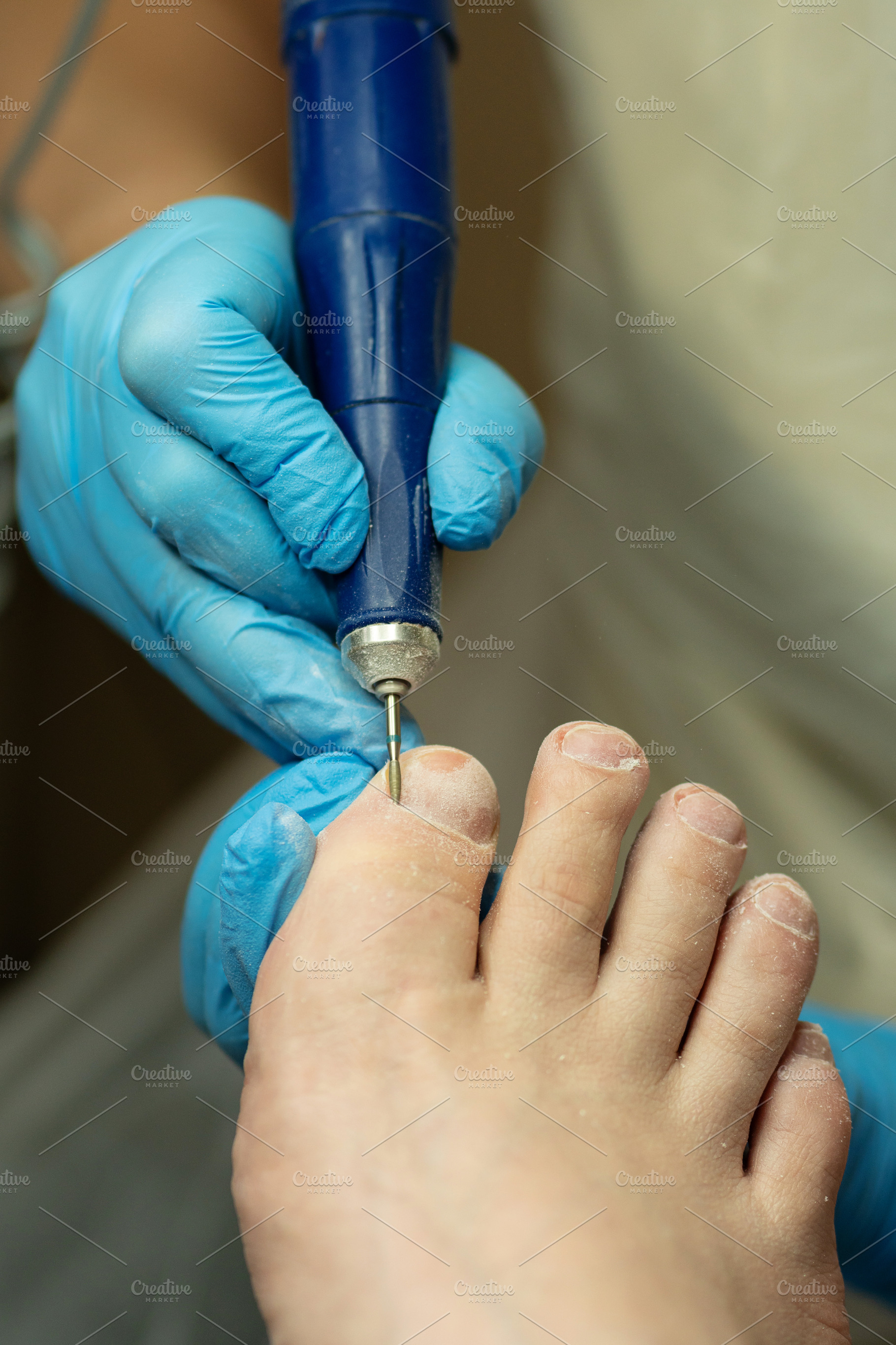 Technician performs dry pedicure, a Health & Medical Photo by Elena Vagengeim