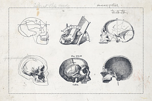 Craniometry