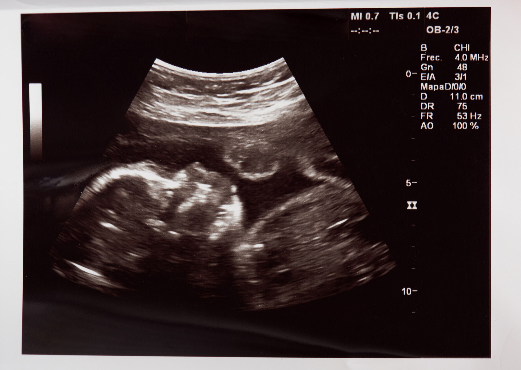 Baby head on ultrasound scan, a Health & Medical Photo by PixieMe