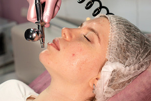Esthetician sprays fine facial mist, a Health & Medical Photo by Elena Vagengeim