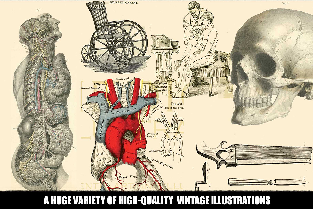 100 Vintage Medical Illustrations, a Healthcare Illustration by Dene Studios (Photo 5 of 7)