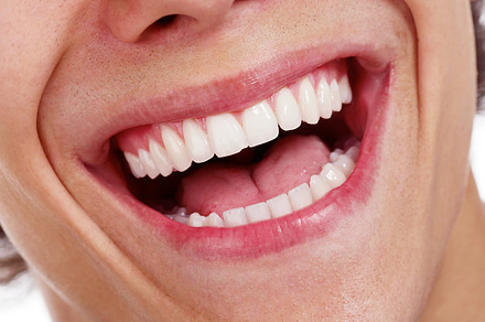 Awesome healthy teeth preview 6