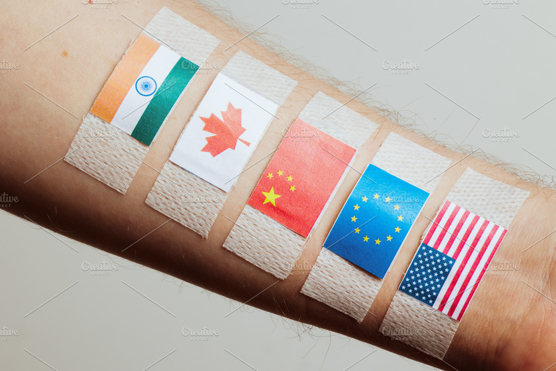 Trade Alliance Tensions - Bandaged Arm with Flags, a Business Photo by Alliance Images