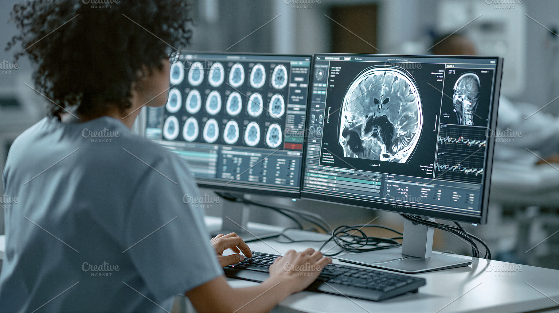 Radiologist examining brain scans, a Health & Medical Photo by 7DesignLab