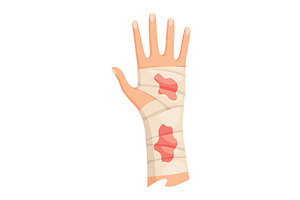 Hands injured skin and, an Object Illustration by Things for designers