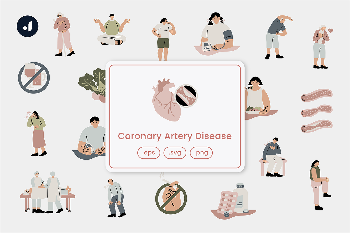 Coronary Artery Disease Illustration, an Object Graphic by Jump Studio (Photo 1 of 4)