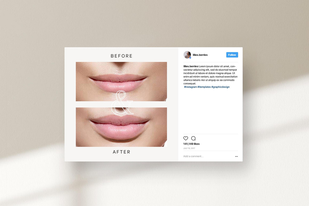 Aesthetic Nurse Injector templates, a Social Media Template by LiliesandBerries (Photo 20 of 23)
