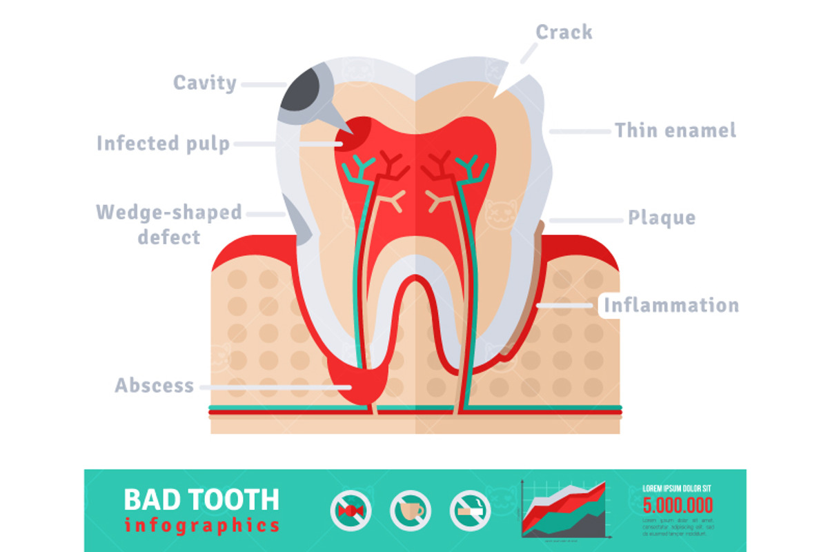 Bad tooth, a Healthcare Illustration by kotoffei