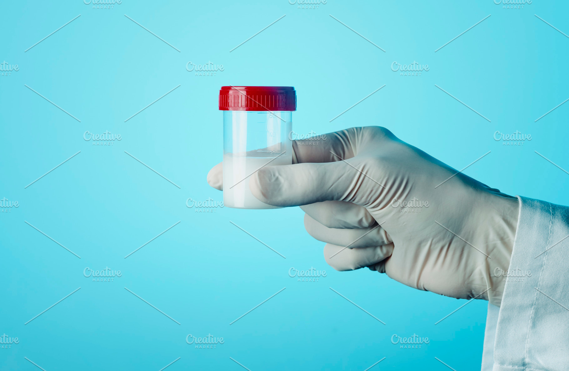 man with a sterile container with semen, a Photo by Nito