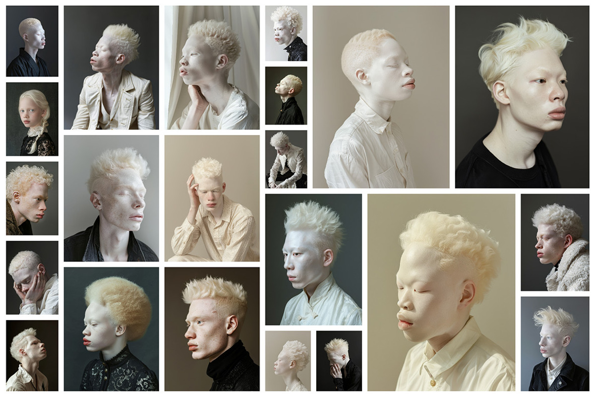 66 Albino persons, a Person Photo by Handmadefont (Photo 4 of 10)