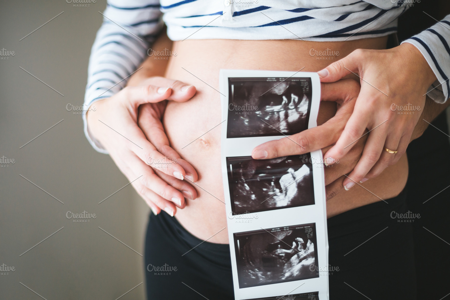 Couple hands holding ultrasound imag, a Person Photo by asife