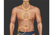 Scars Set, a Healthcare Illustration by Zonda (Thumbnail 9 of 13)