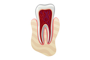 Dental implant. Medical educative, an Object Illustration by the8monkey