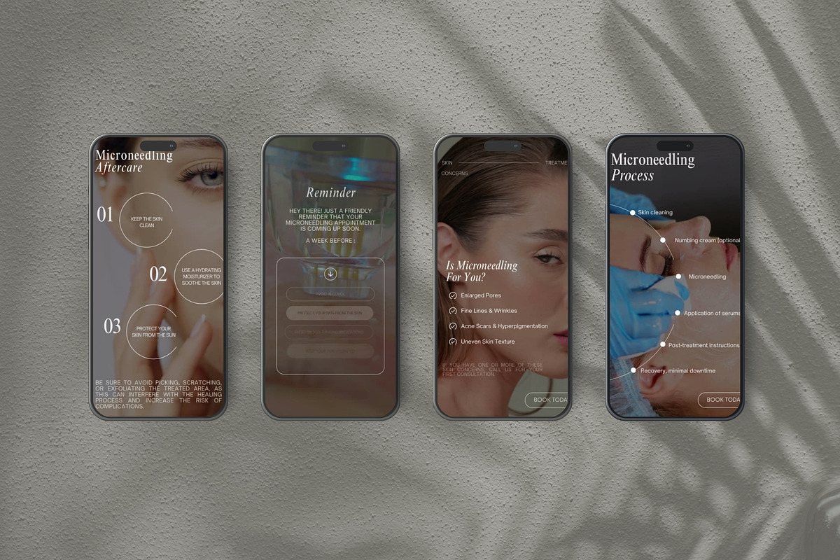Microneedling Instagram Template, a Social Media Template by Terraa Studio Design (Photo 2 of 6)