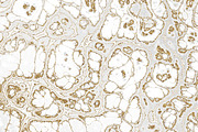 Marble textures 8000 x 8000 px, a Texture Graphic by tkdesign (Thumbnail 16 of 21)
