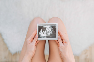 Ultrasound scan of the child, a Health & Medical Photo by SOTNIKOV_MISHA