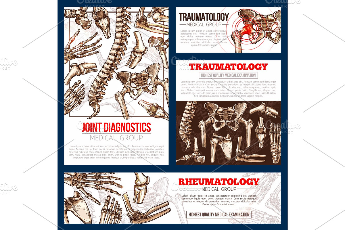 Medical banner template set of bone, joint x-ray, a Healthcare ...