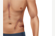 Scars Set, a Healthcare Illustration by Zonda (Thumbnail 5 of 13)