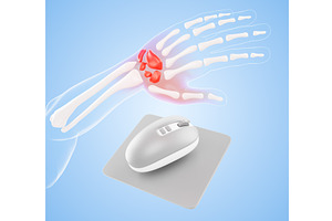 3d wrist pain - arm hand bones with, a Healthcare Illustration by Marozhkastudio