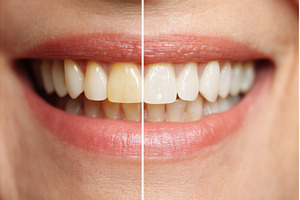 Dentistry involves the treatment and, a Person Photo by ZinetroN