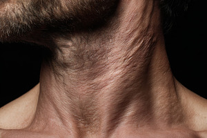 Neck Muscle Definition, a Person Photo by Virgo Studio