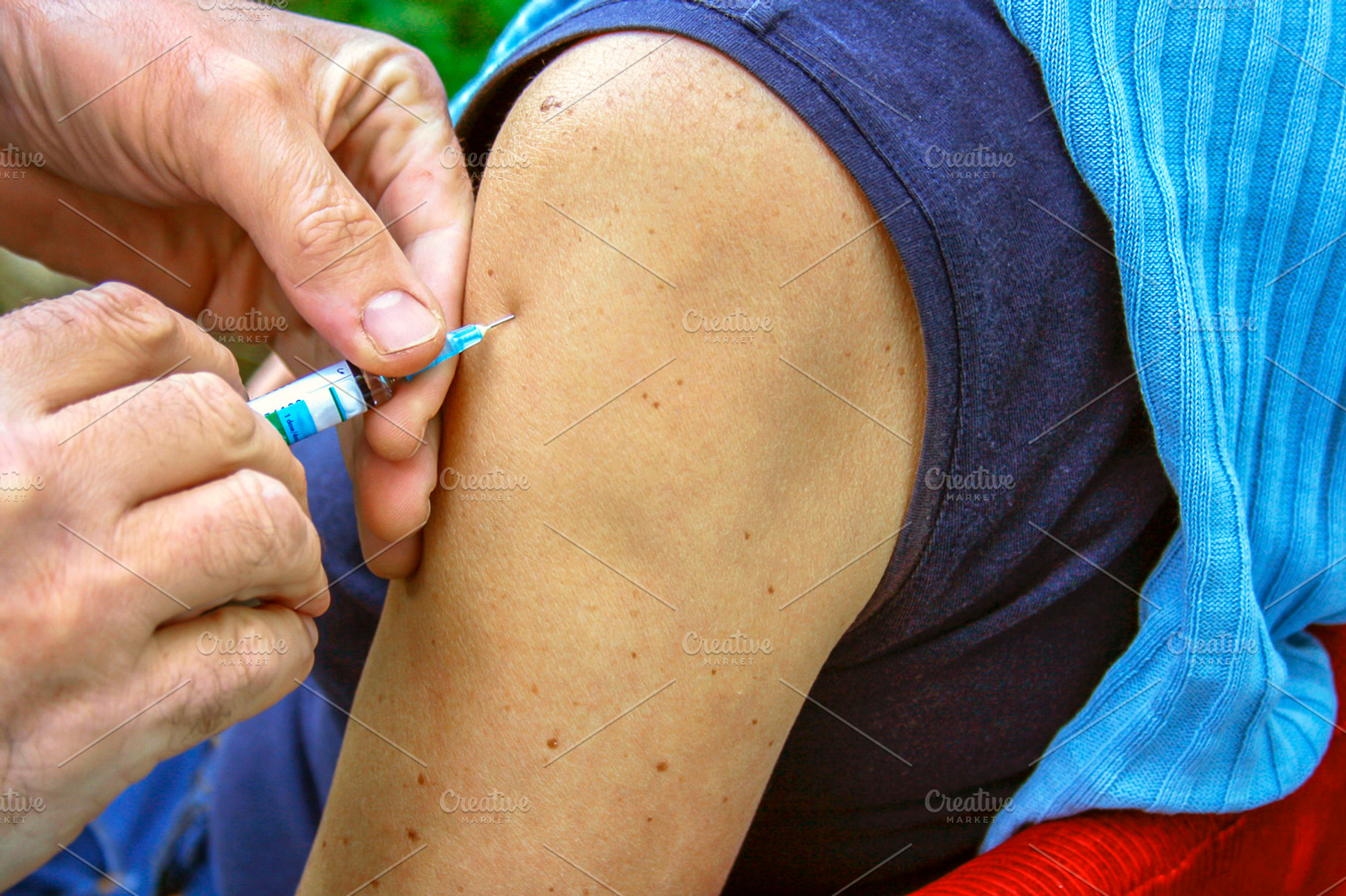Arm injection