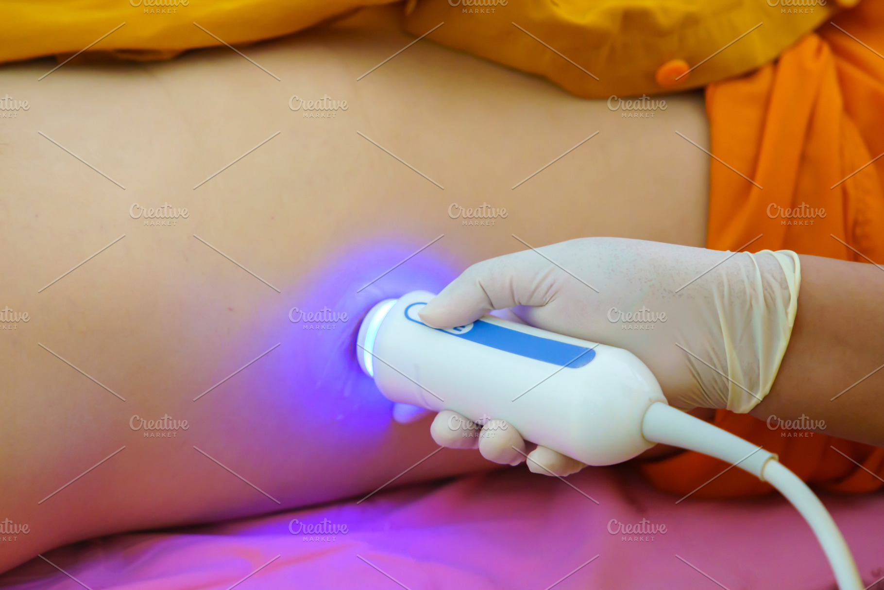 Closeup of man getting an fibroscan or ultrasound scan on abdomi, a Health & Medical Photo by Casanowe-studio