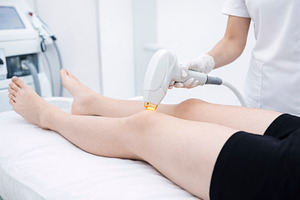 having laser hair removal on legs, generative AI, a Photo by Nito