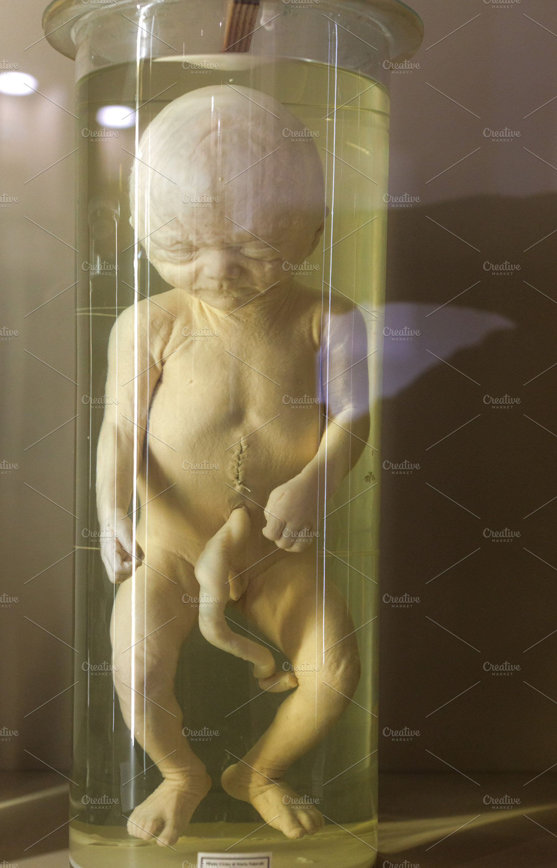 Human fetus 7 th month in glass container with formalin, a School & Education Photo by Bepslabor