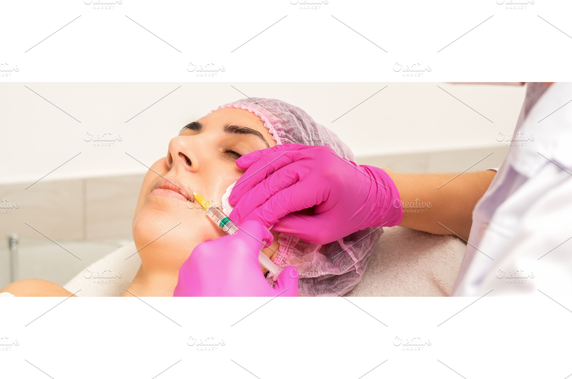 Young caucasian woman getting botox, a Health & Medical Photo by okskukuruza