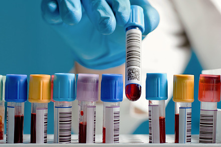 blood sample tube, a Health & Medical Photo by angellodeco