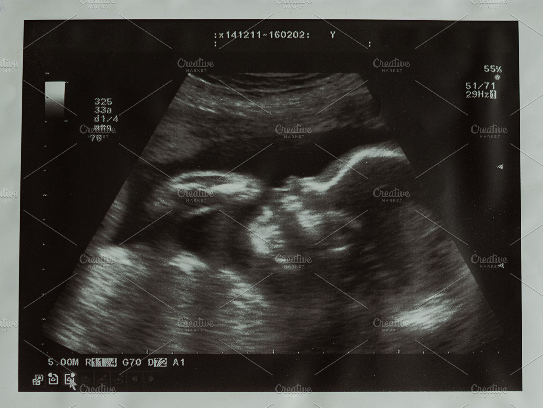 Ultrasound picture of baby containing ultrasound, baby, and pregnancy, a Health & Medical Photo by NelliKovalchuk