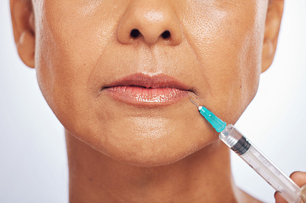 Lips, injection and face of woman for plastic surgery in studio, white background and skincare. Closeup of female model, cosmetics and syringe on mouth for dermatology, facelift and filler for beauty, a Photo by Peopleimages.com