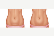 Scars Set, a Healthcare Illustration by Zonda (Thumbnail 6 of 13)