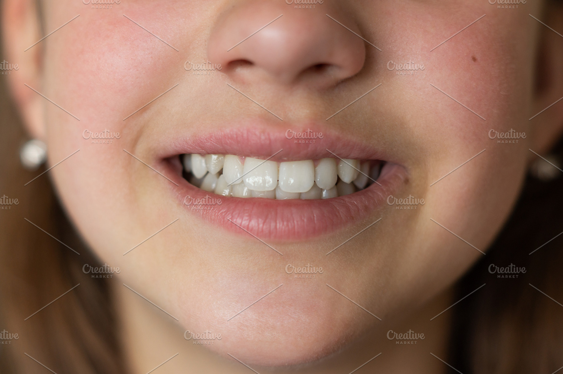 Child's white teeth close up, a Health & Medical Photo by Nastya_Velko