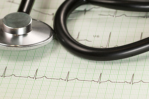 Stethoscope on electrocardiogram featuring medical, record, and patient