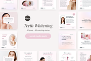 Canva Teeth Whitening templates, a Social Media Template by LiliesandBerries (Thumbnail 2 of 22)
