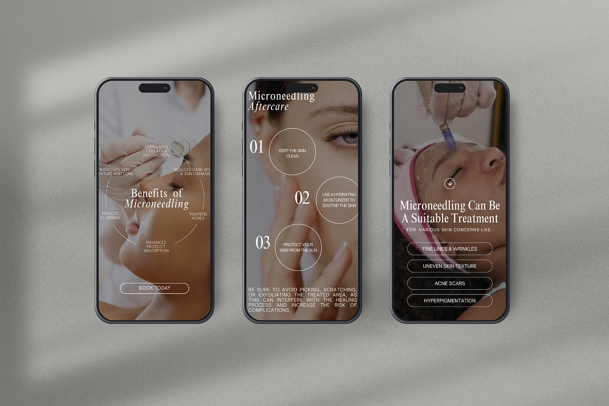 Microneedling Instagram Template, a Social Media Template by Terraa Studio Design (Photo 5 of 6)