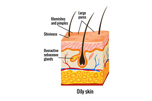 Oily skin anatomy. Human body, a Healthcare Illustration by Things for designers