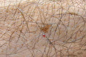 Persons arm detail showing skin and hair texture, a Health & Medical Photo by DanFLCreativo