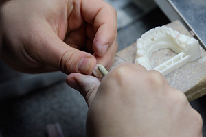 Dental technician carefully polishing a zirconium dioxide crown or veneer., a Health & Medical Photo by Rohan Photography