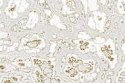 Marble textures 8000 x 8000 px, a Texture Graphic by tkdesign (Thumbnail 8 of 21)