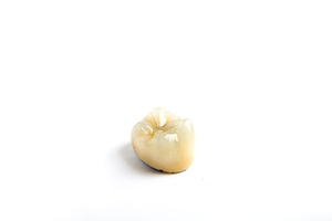 Dental ceramic tooth crowns on white background isolated stock photo