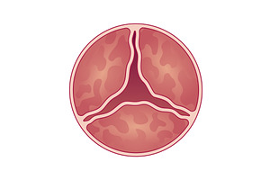 Medical illustration shows, an Object Illustration by Things for designers