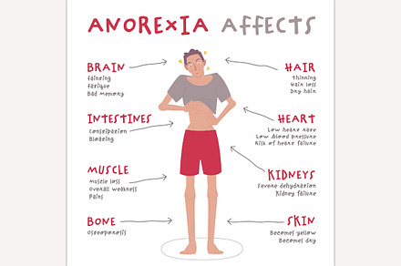Eating disorder in men and boys.