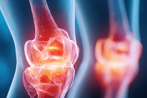 Glowing knee joint illustration depicting pain, a Health & Medical Photo by AlyaAnd