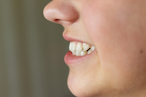 Close-up of even white healthy teeth